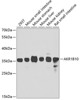 Anti-AKR1B10