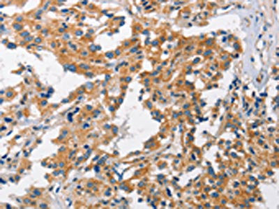 Anti-CHMP1A