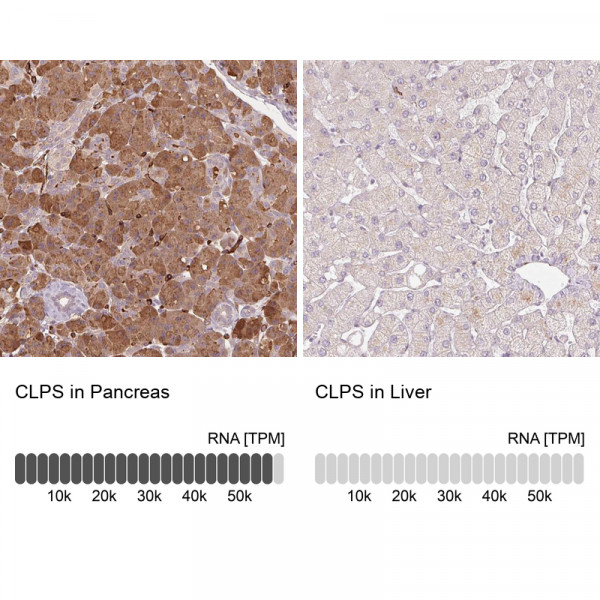Anti-CLPS