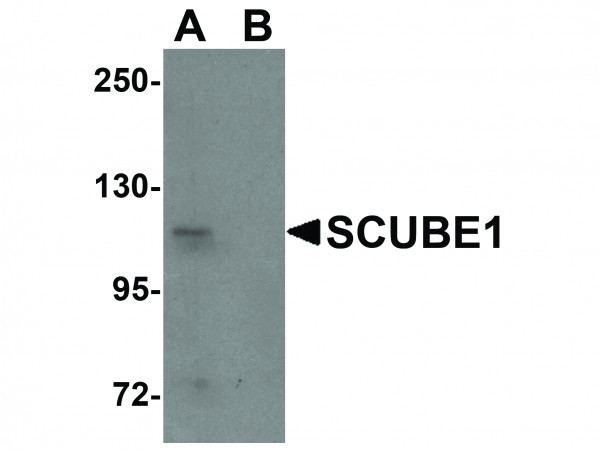 Anti-SCUBE1