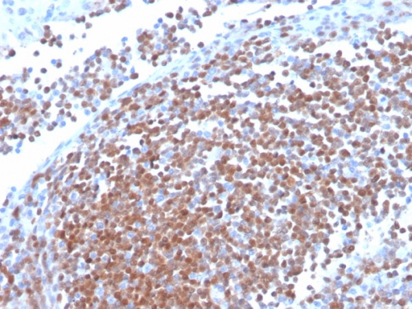Anti-Cyclin D1 (G1-Cyclin &amp; Mantle Cell Lymphoma Marker), recombinant antibody, clone CCND1/3370R