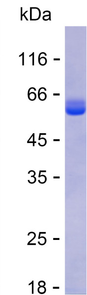 Recombinant Human TXNDC16 Protein