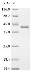 Virulence sensor protein PhoQ (phoQ), partial, recombinant Shigella flexneri