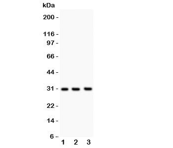 Anti-PSA (Prostate Specific Antigen)