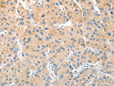Anti-RPN1