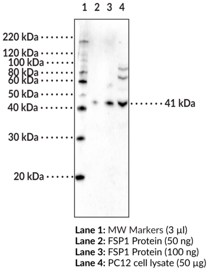 Anti-FSP1