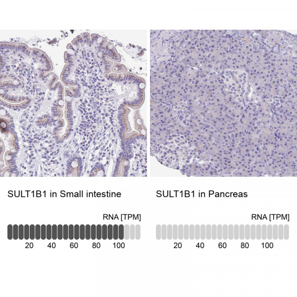 Anti-SULT1B1