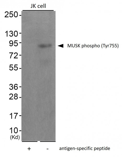 Anti-phospho-MUSK (Tyr755)