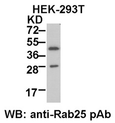 Anti-Rab25