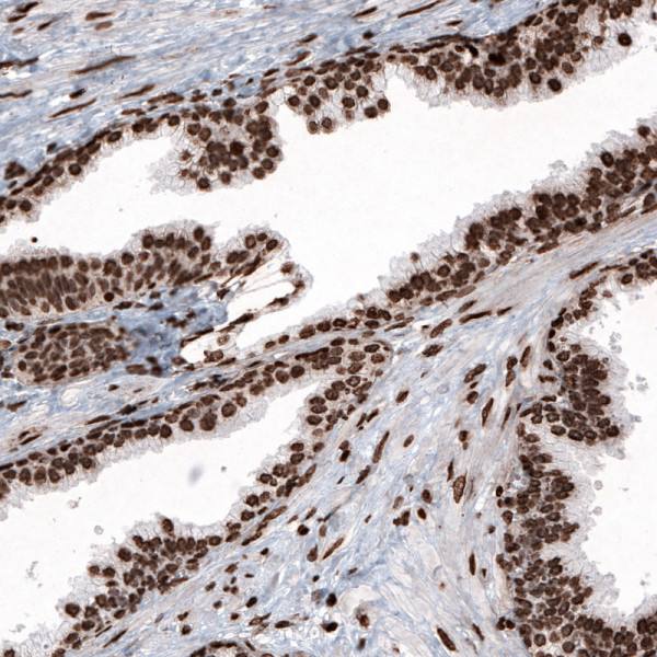 Anti-HIST1H2BC, clone CL5048