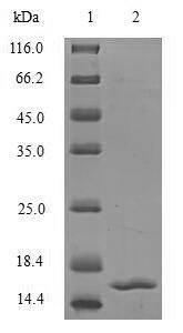 Transforming growth factor beta-2 (TGFB2), partial, human, recombinant