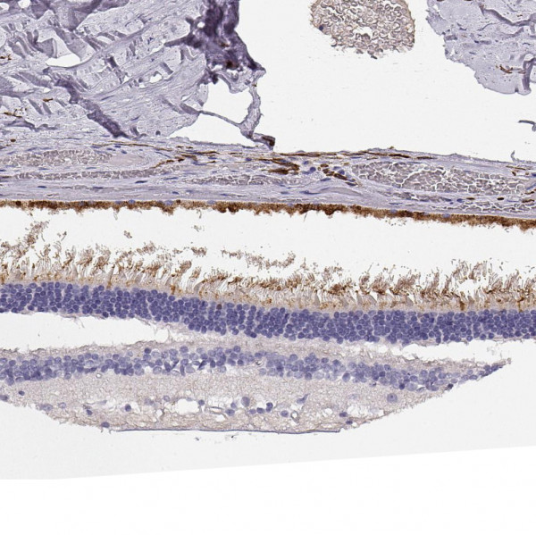 Anti-CDHR1