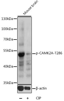 Anti-phospho-Camk2a-T286