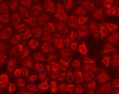Anti-FMO5