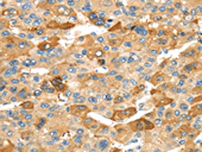 Anti-RHCG