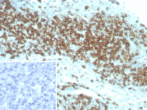 Anti-CD2 / Lymphocyte Function Antigen 2 (LFA-2), recombinant antibody, clone LFA2/8845R