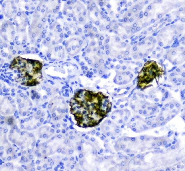 Anti-Nephrin