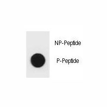 Anti-phospho-BAD (Ser96)