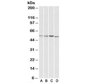 Anti-AKT3