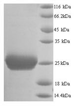Thrombospondin-2 (Thbs2), partial, mouse, recombinant