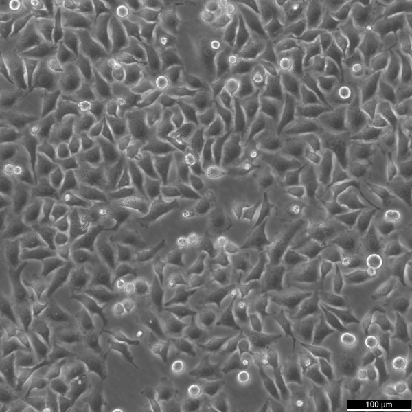 HK Mad2-LAP/H2B-mCherry Cells