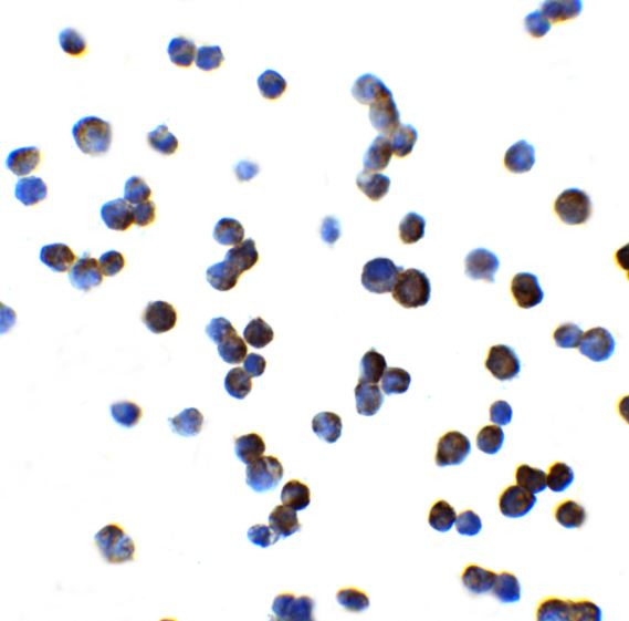 Anti-SLCO1B1 / OATP1B1