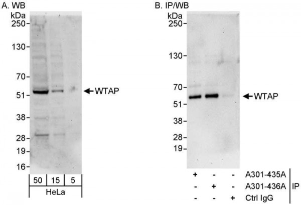 Anti-WTAP