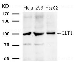 Anti-GIT1 (Ab-383)
