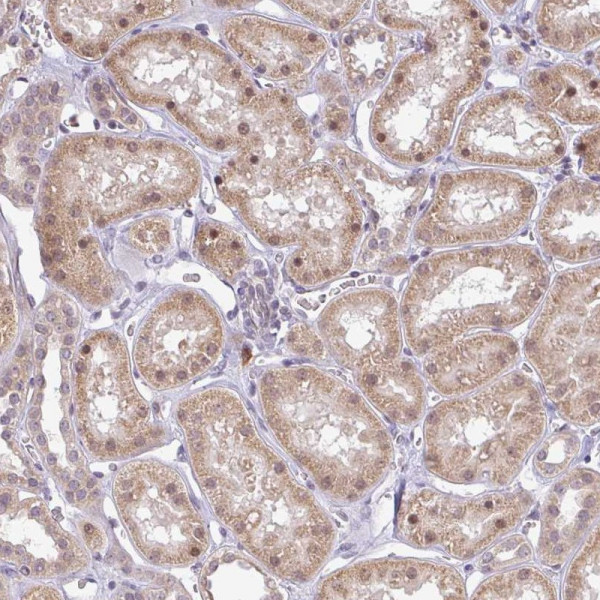 Anti-FAM153A