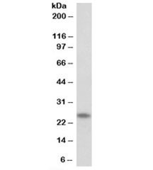 Anti-TNNI1