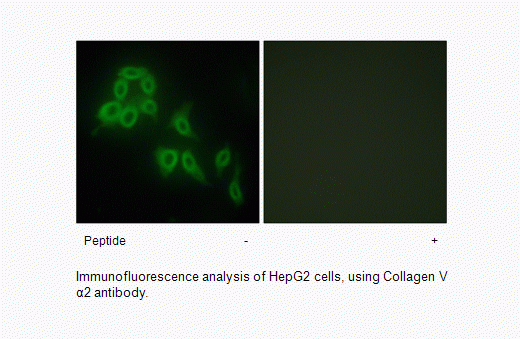 Anti-Collagen V alpha2