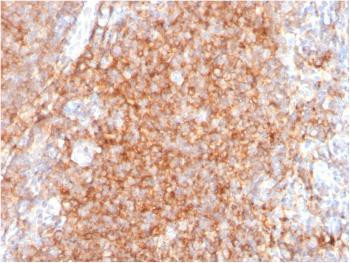 Anti-CD40/ TNFRSF5 / CD40L-Receptor Monoclonal Antibody (Clone: C40/2383)