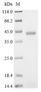 Hypoxia up-regulated protein 1 (HYOU1), partial, human, recombinant