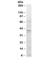 Anti-SERPINI2
