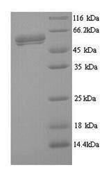 respiratory syncytial virus A Fusion glycoprotein F0 (F), partial, human, recombinant