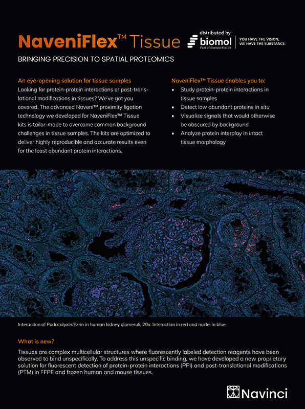 NaveniFlex Tissue