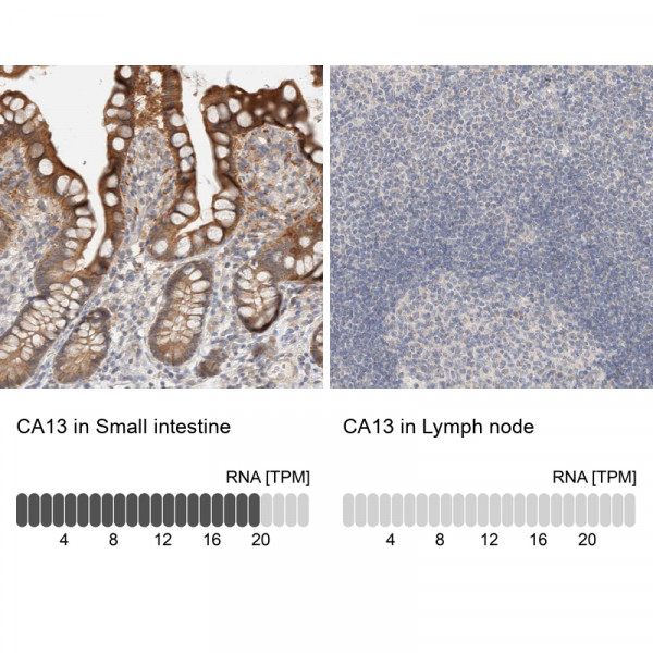 Anti-CA13