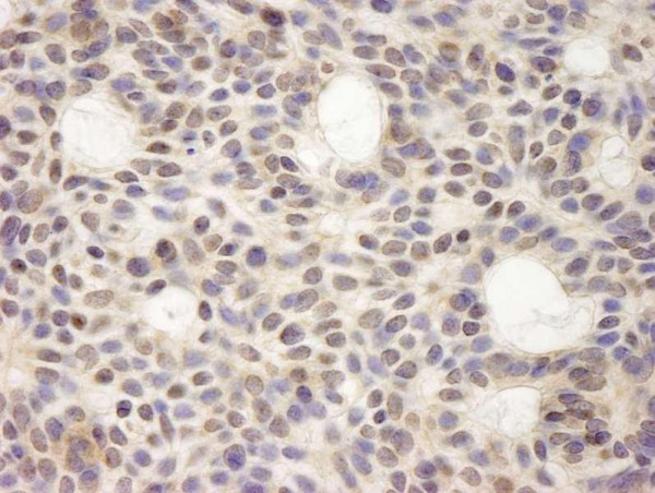 Anti-HURP/DLG7 (IHC)