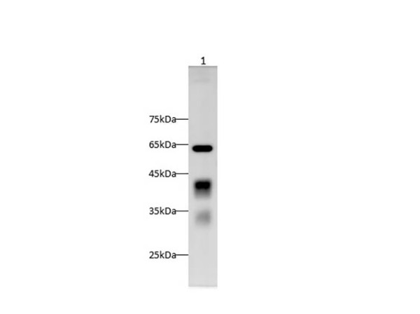 Anti-Clusterin