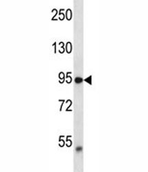 Anti-TRPV2