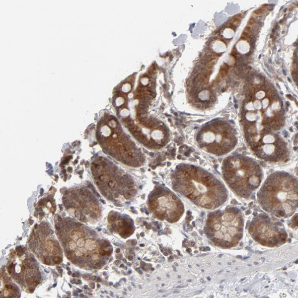 Anti-ARIH1