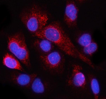 Anti-NUP98 / Nucleoporin 98