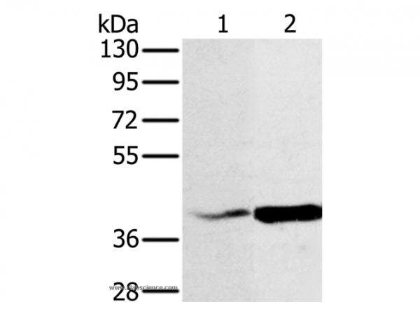 Anti-NDUFA10