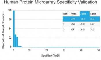 Anti-Leptin Receptor / LEPR, clone LEPR/4301