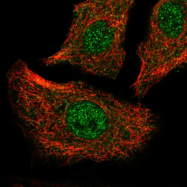 Anti-ATP2A2