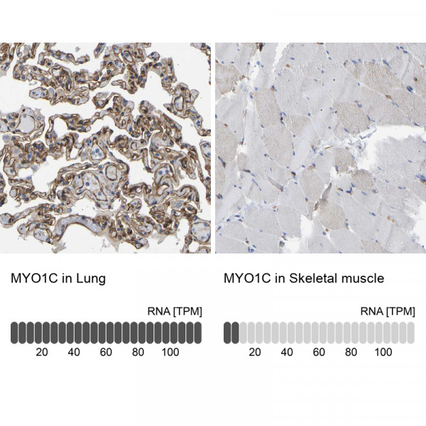 Anti-MYO1C