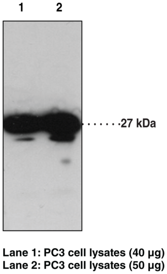 Anti-GPR31 (C-Term)