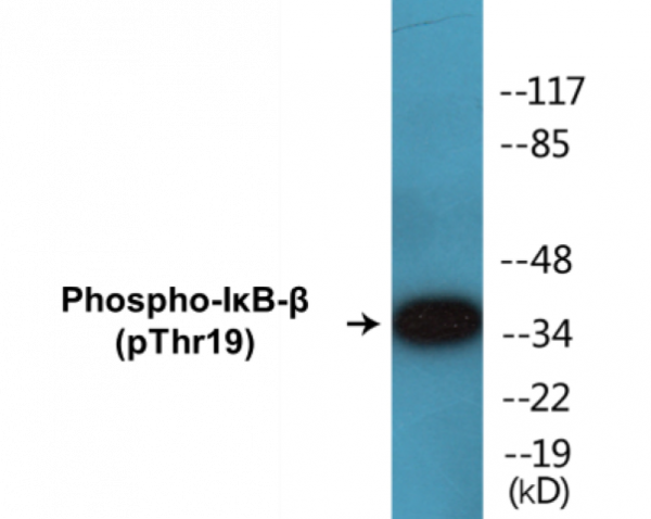 IkappaB-beta (Phospho-Thr19) Colorimetric Cell-Based ELISA Kit