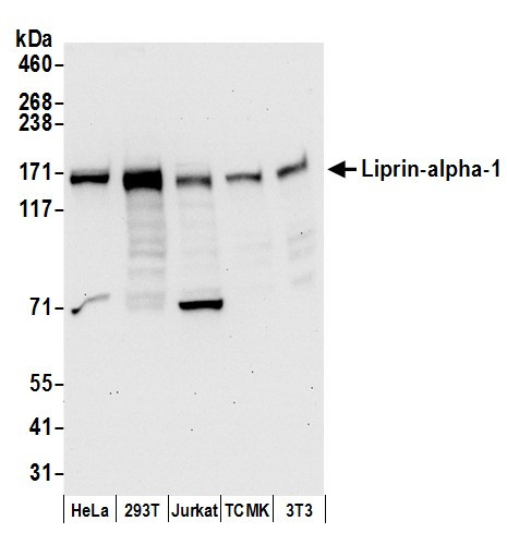 Anti-Liprin-alpha-1