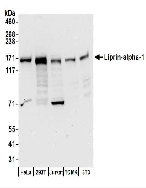 Anti-Liprin-alpha-1
